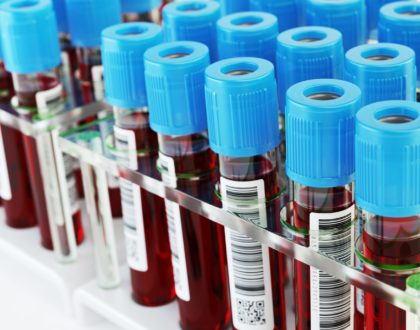 Devo fazer o teste de sorologia após a vacina contra Covid-19? - por: Dra. Nayara Figueira